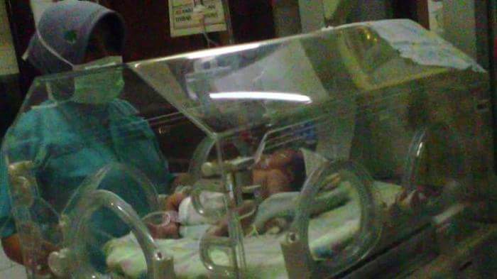 bayi kembar siam 2 kepala 1 organ vital lahir di gresik jawa timur tanggal 9 agustus 2016