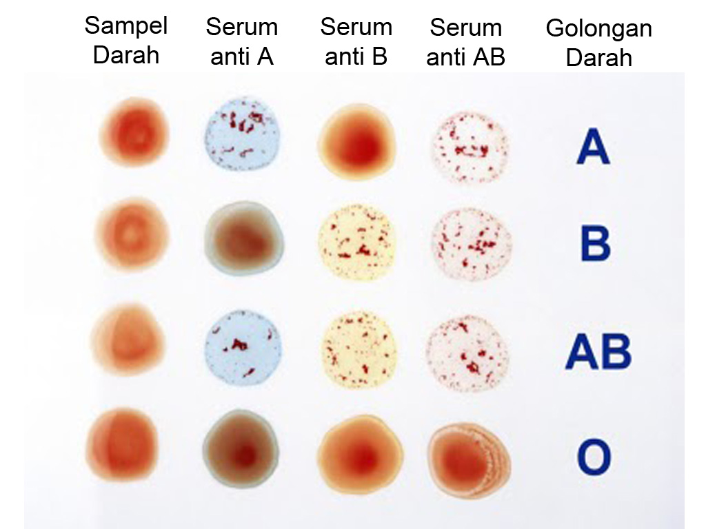 Mengintip sifat seseorang dari golongan darahnya brosis (A,B,AB dan O)